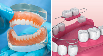 Dentures & Bridges