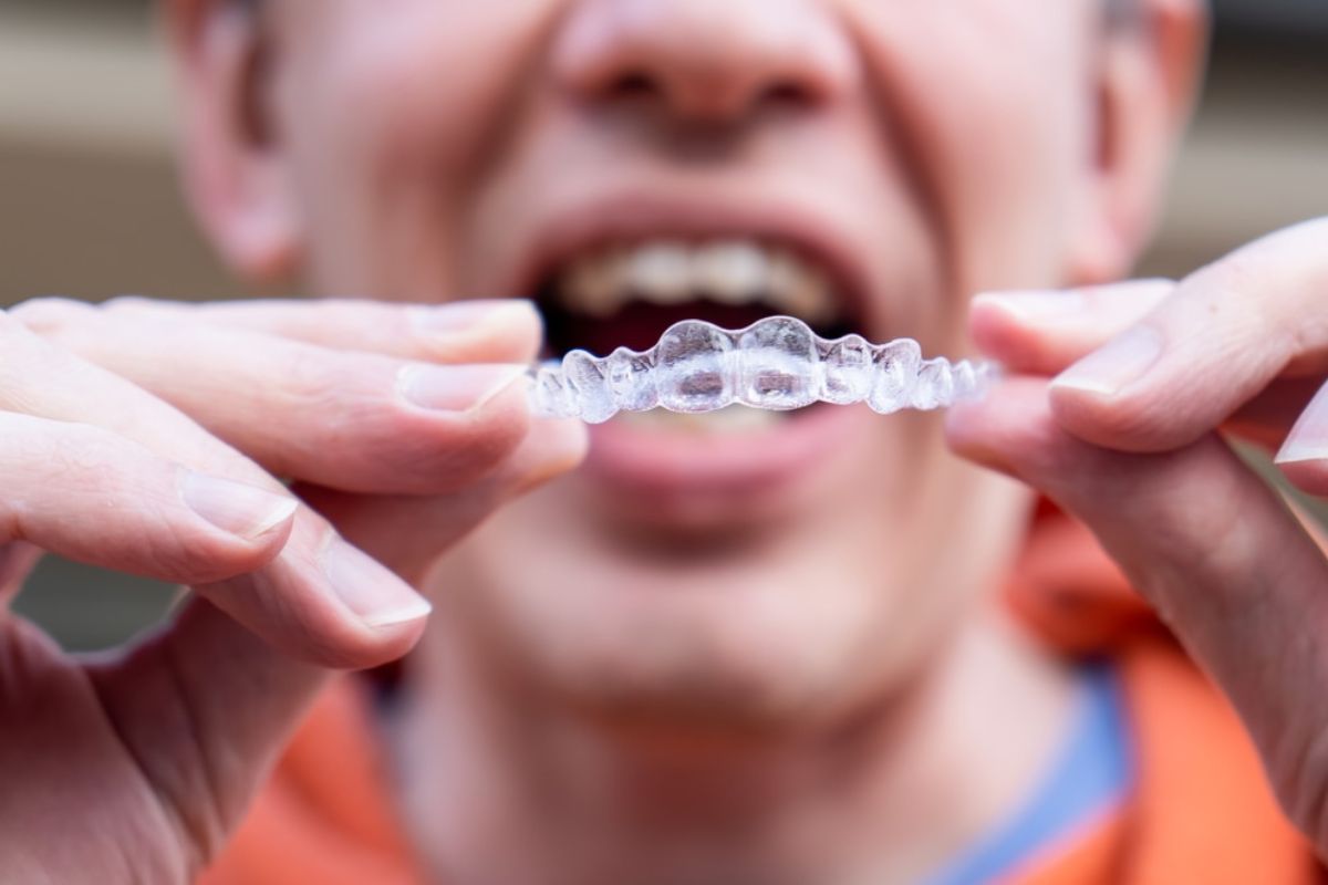 Your Guide to Maintaining Invisalign Results the Right Way