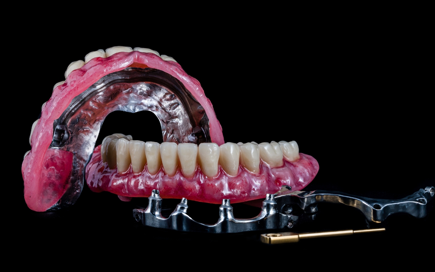 Patients Success Rate of All-on-4 Implants